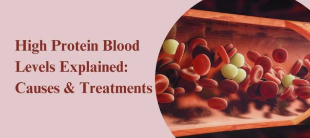 High-Protein-Blood-Levels-Explained-Causes-Treatments