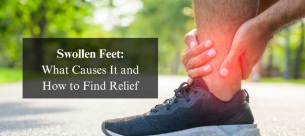 Swollen-Feet-What-Causes-It-and-How-to-Find-Relief.