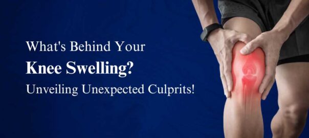 Whats-Behind-Your-Knee-Swelling-Unveiling-Unexpected-Culprits