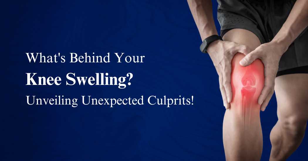 Whats-Behind-Your-Knee-Swelling-Unveiling-Unexpected-Culprits