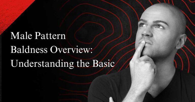 Male Pattern Baldness Overview: Understanding the Basic - Glatt Life